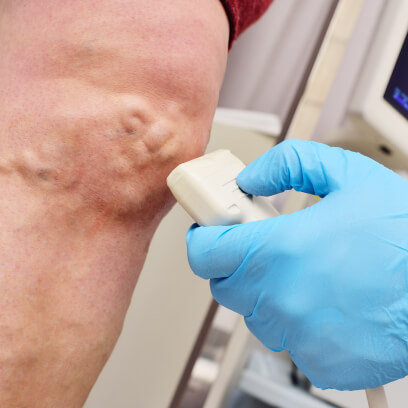 Examining veins on the legs - vein specialists in Michigan