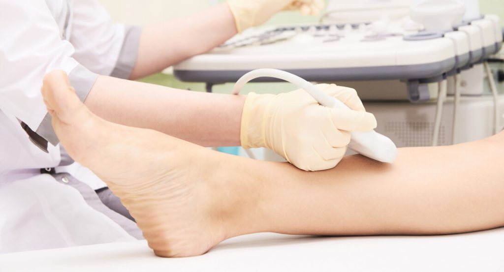 Vascular Ultrasound Studies | Michigan Vein Doctor